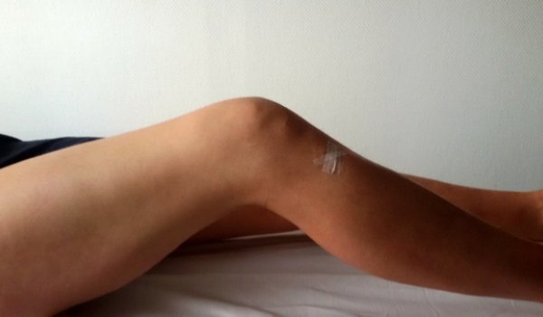 Meine Knie-Operation